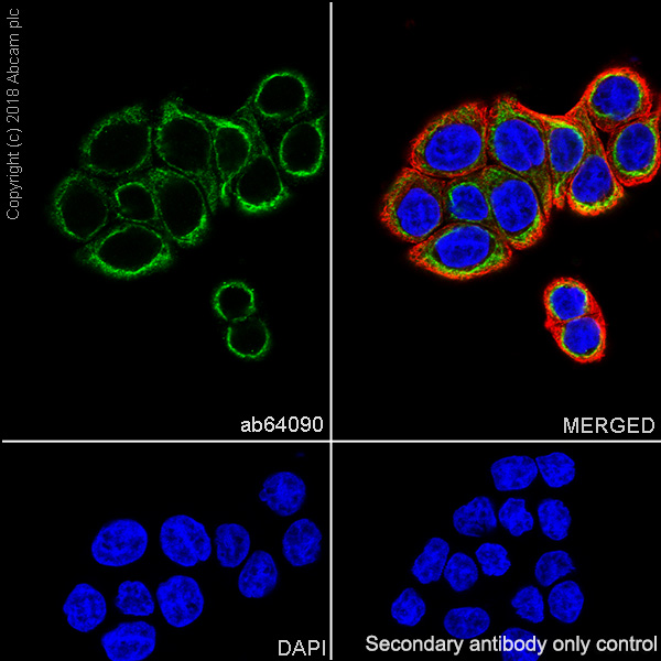 Immunocytochemistry/ Immunofluorescence - Anti-Cytokeratin 20 antibody [SP33] (AB64090), expandable thumbnail
