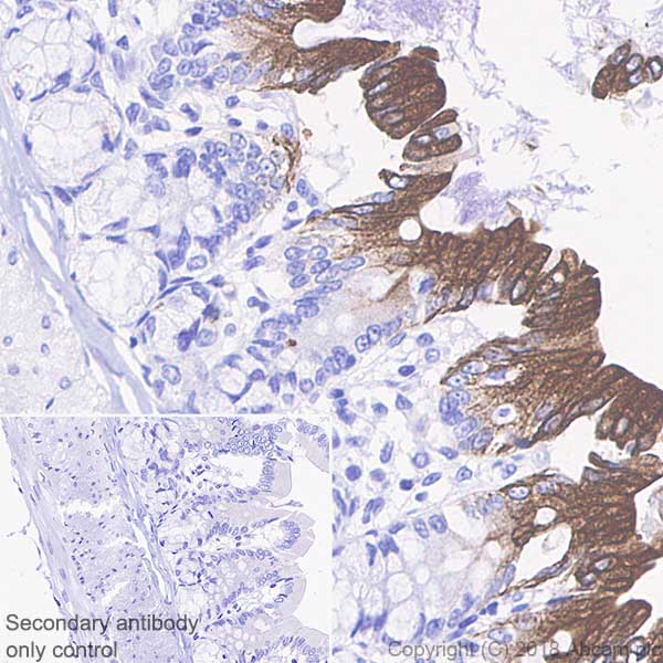 Immunohistochemistry (Formalin/PFA-fixed paraffin-embedded sections) - Anti-Cytokeratin 20 antibody [SP33] (AB64090), expandable thumbnail