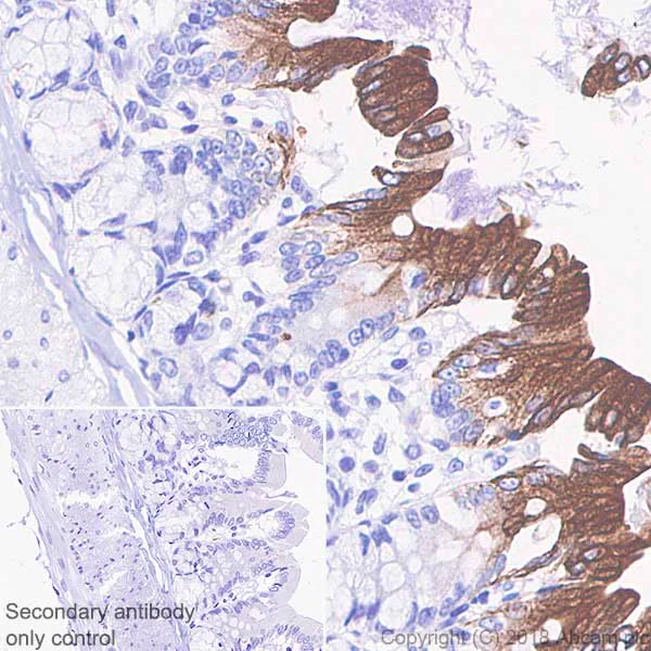 Immunohistochemistry (Formalin/PFA-fixed paraffin-embedded sections) - Anti-Cytokeratin 20 antibody [SP33] (AB64090)