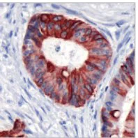 Immunohistochemistry (Formalin/PFA-fixed paraffin-embedded sections) - Anti-Cytokeratin 20 antibody [SP33] (AB64090)
