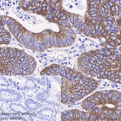 Immunohistochemistry (Formalin/PFA-fixed paraffin-embedded sections) - Anti-Cytokeratin 20 antibody [SP33] (AB64090), expandable thumbnail