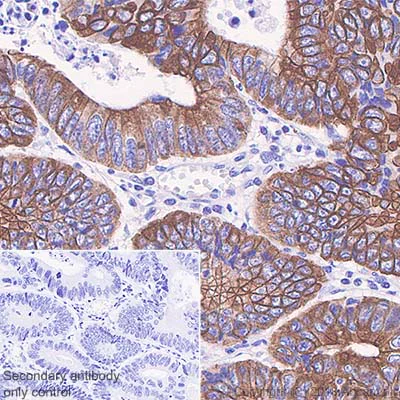 Anti-Cytokeratin 20 antibody [SP33] (ab64090) | Abcam