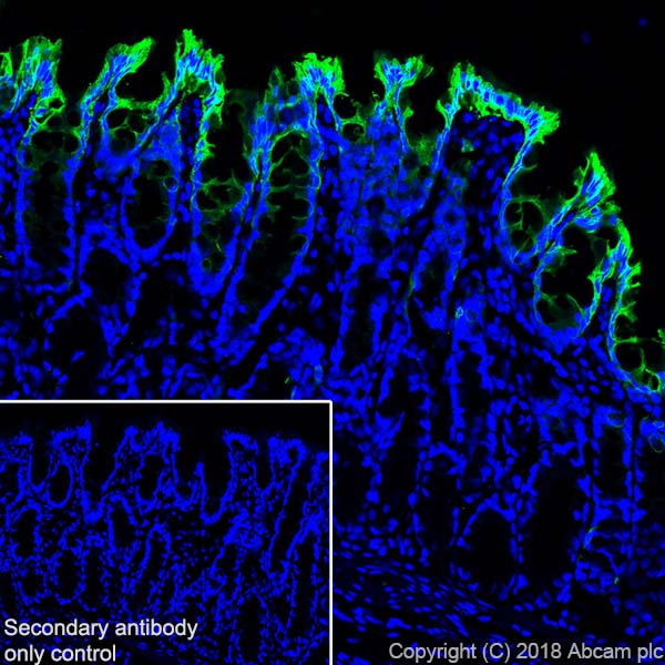 Immunohistochemistry (Frozen sections) - Anti-Cytokeratin 20 antibody [SP33] (AB64090), expandable thumbnail