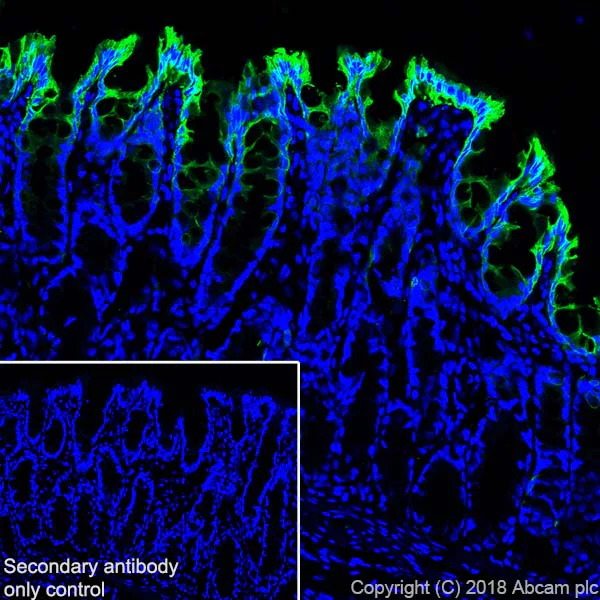 Immunohistochemistry (Frozen sections) - Anti-Cytokeratin 20 antibody [SP33] (AB64090)