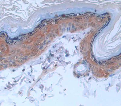 Immunohistochemistry (Formalin/PFA-fixed paraffin-embedded sections) - Anti-Cytokeratin 2e antibody (AB231608)