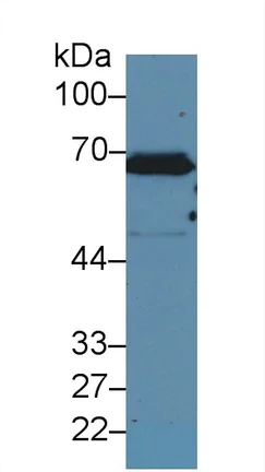 Western blot - Anti-Cytokeratin 2e antibody (AB231608)