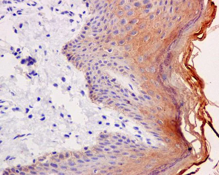 Immunohistochemistry (Formalin/PFA-fixed paraffin-embedded sections) - Anti-Cytokeratin 2e antibody [EPR10911] (AB170106)