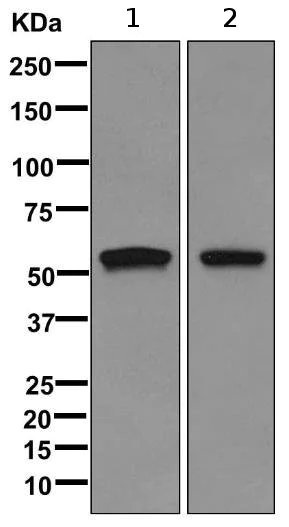 Western blot - Anti-Cytokeratin 2e antibody [EPR10911] (AB170106)