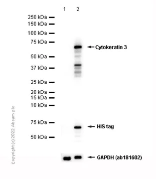 Western blot - Anti-Cytokeratin 3/CK-3 antibody [AE5] (AB68260)