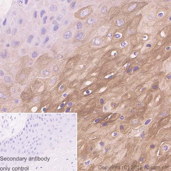Immunohistochemistry (Formalin/PFA-fixed paraffin-embedded sections) - Anti-Cytokeratin 3/CK-3 antibody [AE5] - BSA and Azide free (AB255962)