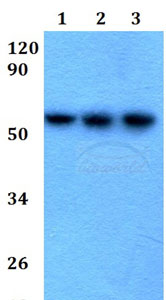 Western blot - Anti-Cytokeratin 4 antibody (AB200669), expandable thumbnail