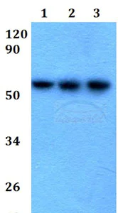 Western blot - Anti-Cytokeratin 4 antibody (AB200669)