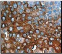 Immunohistochemistry (Formalin/PFA-fixed paraffin-embedded sections) - Anti-Cytokeratin 4 antibody [EP1599Y] - BSA and Azide free (AB247316)