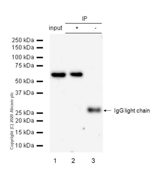 Immunoprecipitation - Anti-Cytokeratin 4 antibody [EP1599Y] - BSA and Azide free (AB247316)