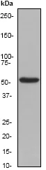 Western blot - Anti-Cytokeratin 4 antibody [EP1599Y] - BSA and Azide free (AB247316)