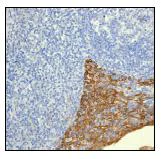 Immunohistochemistry (Formalin/PFA-fixed paraffin-embedded sections) - Anti-Cytokeratin 4 antibody [EPR1598] - BSA and Azide free (AB247558)