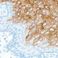 Immunohistochemistry (Formalin/PFA-fixed paraffin-embedded sections) - Anti-Cytokeratin 4 antibody [SP210] - BSA and Azide free (AB242402)