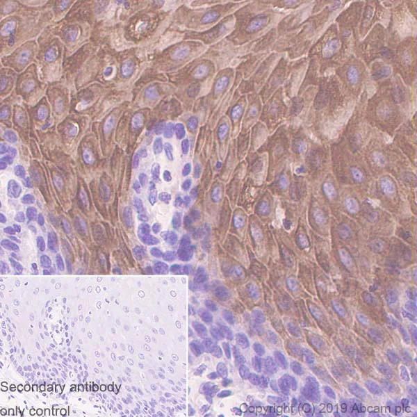 Immunohistochemistry (Formalin/PFA-fixed paraffin-embedded sections) - Anti-Cytokeratin 4 antibody [SP210] - BSA and Azide free (AB242402)