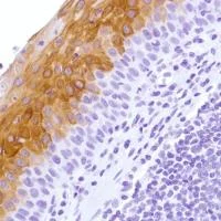 Immunohistochemistry (Formalin/PFA-fixed paraffin-embedded sections) - Anti-Cytokeratin 4 antibody [SP210] - BSA and Azide free (AB242402)