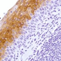 Immunohistochemistry (Formalin/PFA-fixed paraffin-embedded sections) - Anti-Cytokeratin 4 antibody [SP210] - N-terminal (AB183329)