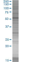 SDS-PAGE - Cytokeratin 4 overexpression 293T lysate (whole cell) (AB94137)