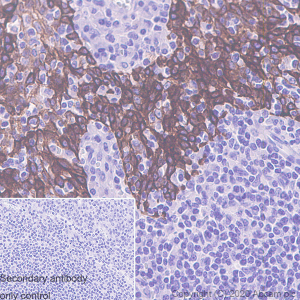 Immunohistochemistry (Formalin/PFA-fixed paraffin-embedded sections) - Anti-Cytokeratin 5 + 6 + 18 antibody [LP34] (AB40), expandable thumbnail