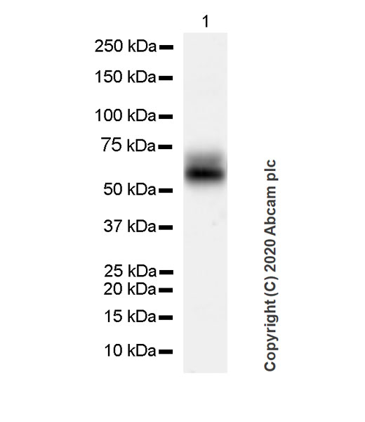 Western blot - Anti-Cytokeratin 5 + 6 + 18 antibody [LP34] (AB40), expandable thumbnail