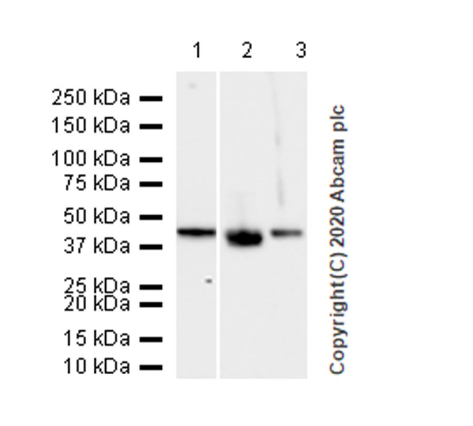 Western blot - Anti-Cytokeratin 5 + 6 + 18 antibody [LP34] (AB40), expandable thumbnail