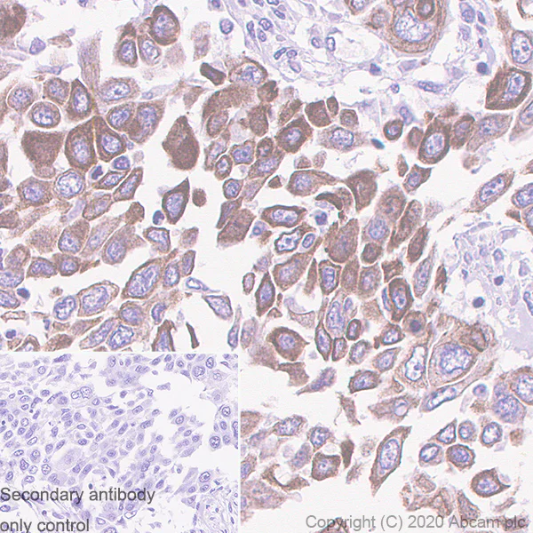 Immunohistochemistry (Formalin/PFA-fixed paraffin-embedded sections) - Anti-Cytokeratin 5 + 6 + 18 antibody [LP34] - BSA and Azide free (AB256139)