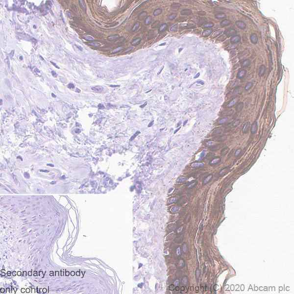 Immunohistochemistry (Formalin/PFA-fixed paraffin-embedded sections) - Anti-Cytokeratin 5 + 6 + 18 antibody [LP34] - BSA and Azide free (AB256139)