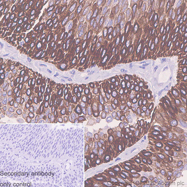 Immunohistochemistry (Formalin/PFA-fixed paraffin-embedded sections) - Anti-Cytokeratin 5 + 6 + 18 antibody [LP34] - BSA and Azide free (AB256139)