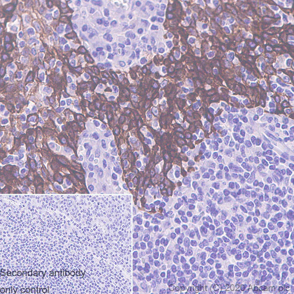 Immunohistochemistry (Formalin/PFA-fixed paraffin-embedded sections) - Anti-Cytokeratin 5 + 6 + 18 antibody [LP34] - BSA and Azide free (AB256139)