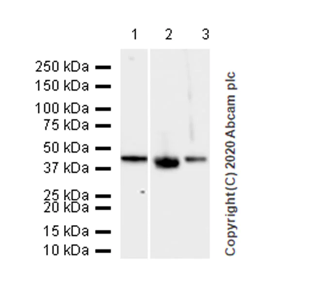 Western blot - Anti-Cytokeratin 5 + 6 + 18 antibody [LP34] - BSA and Azide free (AB256139)