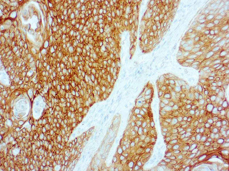 Immunohistochemistry (Formalin/PFA-fixed paraffin-embedded sections) - Anti-Cytokeratin 5 + 6 antibody [D5/16 B4] (AB17133)