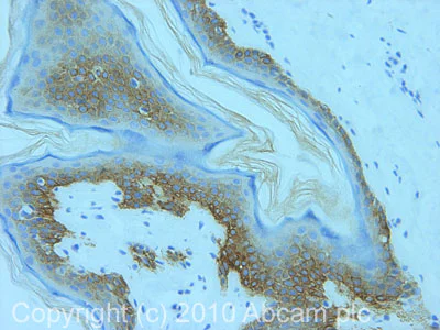 Immunohistochemistry (Formalin/PFA-fixed paraffin-embedded sections) - Anti-Cytokeratin 5 + 8 antibody [RCK102] (AB9005)