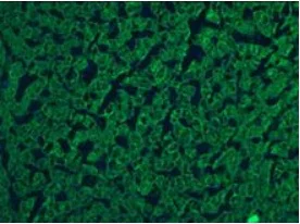 Immunohistochemistry (Frozen sections) - Anti-Cytokeratin 5 + 8 antibody [RCK102] (AB9005)