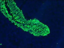 Immunohistochemistry (Frozen sections) - Anti-Cytokeratin 5 + 8 antibody [RCK102] (AB9005)