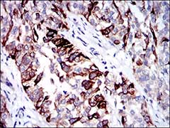 Immunohistochemistry (Formalin/PFA-fixed paraffin-embedded sections) - Anti-Cytokeratin 5 antibody [10C11E6] (AB181491), expandable thumbnail