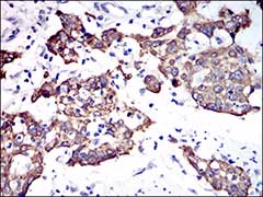 Immunohistochemistry (Formalin/PFA-fixed paraffin-embedded sections) - Anti-Cytokeratin 5 antibody [10C11E6] (AB181491), expandable thumbnail