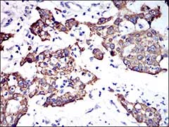 Immunohistochemistry (Formalin/PFA-fixed paraffin-embedded sections) - Anti-Cytokeratin 5 antibody [10C11E6] (AB181491)