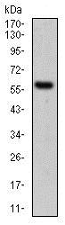 Western blot - Anti-Cytokeratin 5 antibody [10C11E6] (AB181491), expandable thumbnail