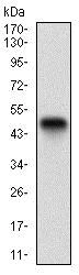 Western blot - Anti-Cytokeratin 5 antibody [10C11E6] (AB181491)