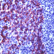 Immunohistochemistry (Formalin/PFA-fixed paraffin-embedded sections) - Anti-Cytokeratin 5 antibody (AB74526)