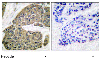 Immunohistochemistry (Formalin/PFA-fixed paraffin-embedded sections) - Anti-Cytokeratin 5 antibody - Cytoskeleton Marker (AB53121), expandable thumbnail