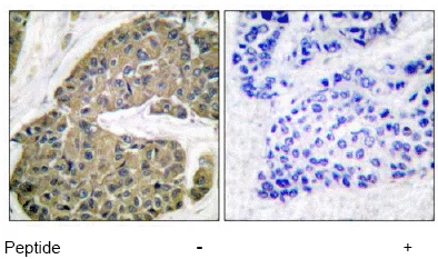 Immunohistochemistry (Formalin/PFA-fixed paraffin-embedded sections) - Anti-Cytokeratin 5 antibody - Cytoskeleton Marker (AB53121)