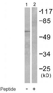 Western blot - Anti-Cytokeratin 5 antibody - Cytoskeleton Marker (AB53121), expandable thumbnail