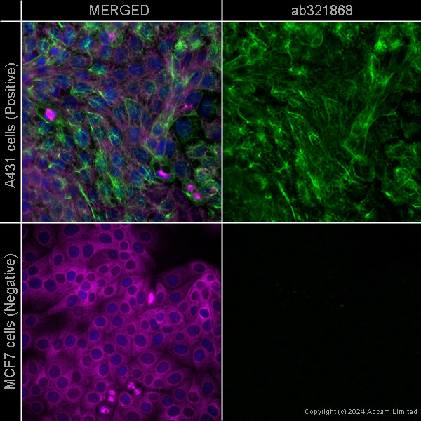 Immunocytochemistry/ Immunofluorescence - Anti-Cytokeratin 5 - Cytoskeleton Marker [EP1601Y] – Goat IgG (Chimeric) – BSA and Azide Free (AB322918), expandable thumbnail