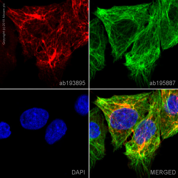 Immunocytochemistry/ Immunofluorescence - Anti-Cytokeratin 5 antibody [EP1601Y] - BSA and Azide free (AB214586), expandable thumbnail