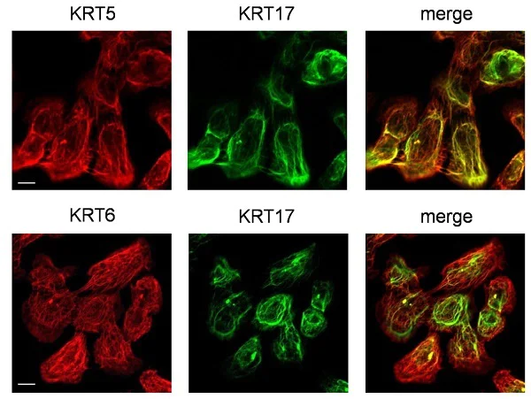 Immunocytochemistry/ Immunofluorescence - Anti-Cytokeratin 5 antibody [EP1601Y] - BSA and Azide free (AB214586)