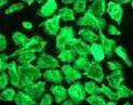 Immunocytochemistry/ Immunofluorescence - Anti-Cytokeratin 5 antibody [EP1601Y] - BSA and Azide free (ab214586), expandable thumbnail